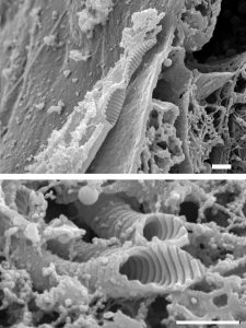 Scanning electron micrographs of tissue that has been frozen and cut to reveal the trachea and taenidia on their inner surface.