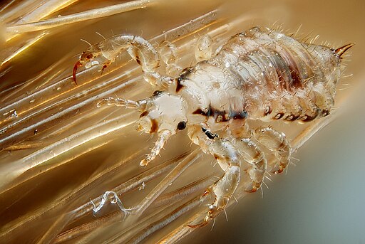photo of a head louse