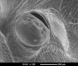 SEM image of a female Strepsiptera protruding from abdomen of a fruit fly.
